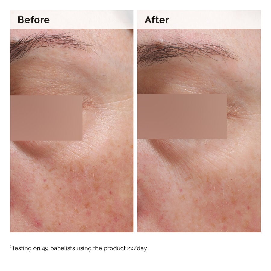 niacinamide-5-face-and-body-emulsion-d5 2024-08-23-ORD-Nia-5pct-Face-Body-B-A-Elasticity-Global-02-1x1.jpg