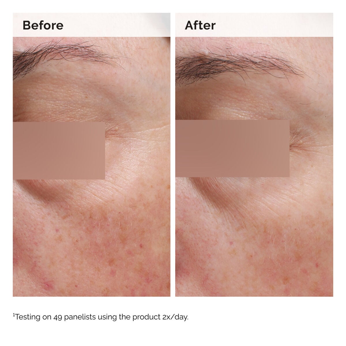 niacinamide-5-face-and-body-emulsion-d5 2024-08-23-ORD-Nia-5pct-Face-Body-B-A-Elasticity-Global-02-1x1.jpg