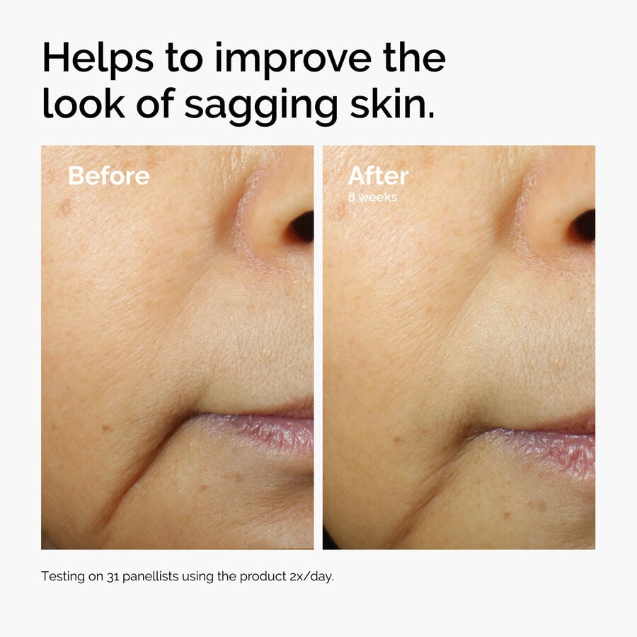 caffeine-3-escin-1-face-serum-t6 ord-caffeine-3pct-escin-1pct-face-serum-before-after-sagging.jpg