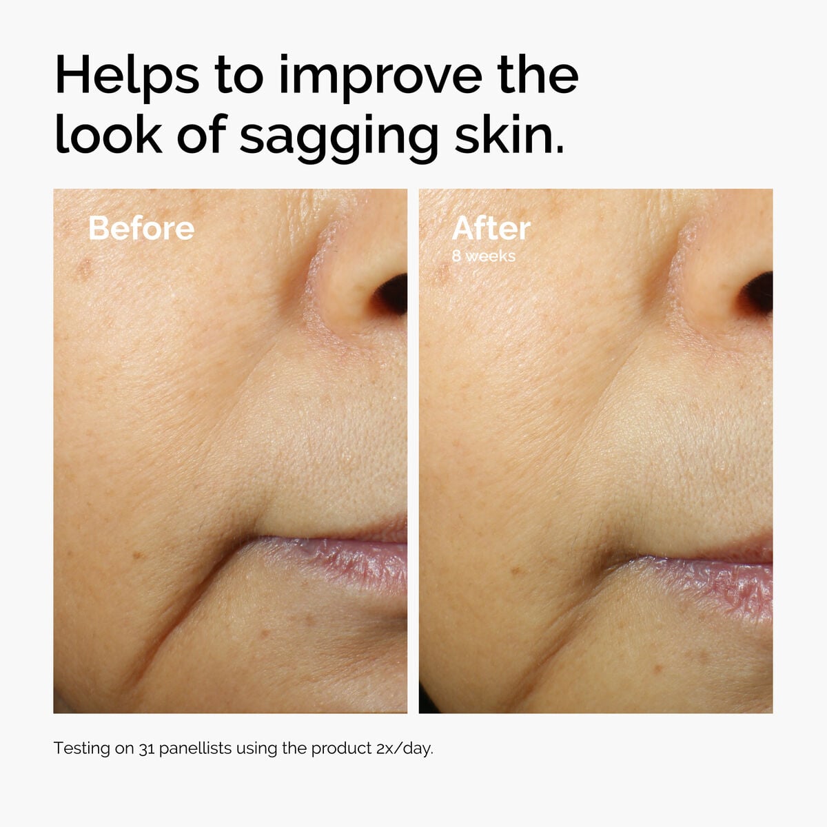 caffeine-3-escin-1-face-serum-t6 ord-caffeine-3pct-escin-1pct-face-serum-before-after-sagging.jpg