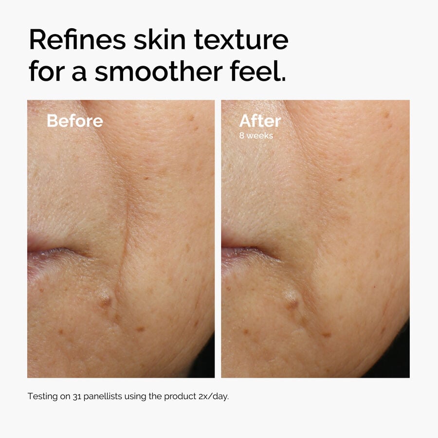caffeine-3-escin-1-face-serum-t6 ord-caffeine-3pct-escin-1pct-face-serum-before-after-texture.jpg