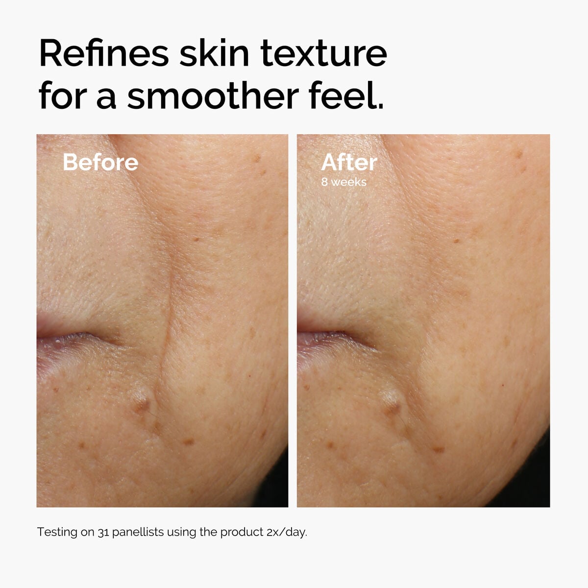 caffeine-3-escin-1-face-serum-t6 ord-caffeine-3pct-escin-1pct-face-serum-before-after-texture.jpg