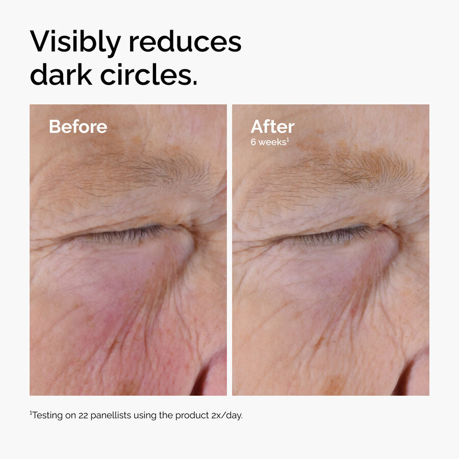caffeine-solution-5-egcg-eye-serum-j0 ord-caffeine-solution-egcg-dark-circles-before-after.jpg
