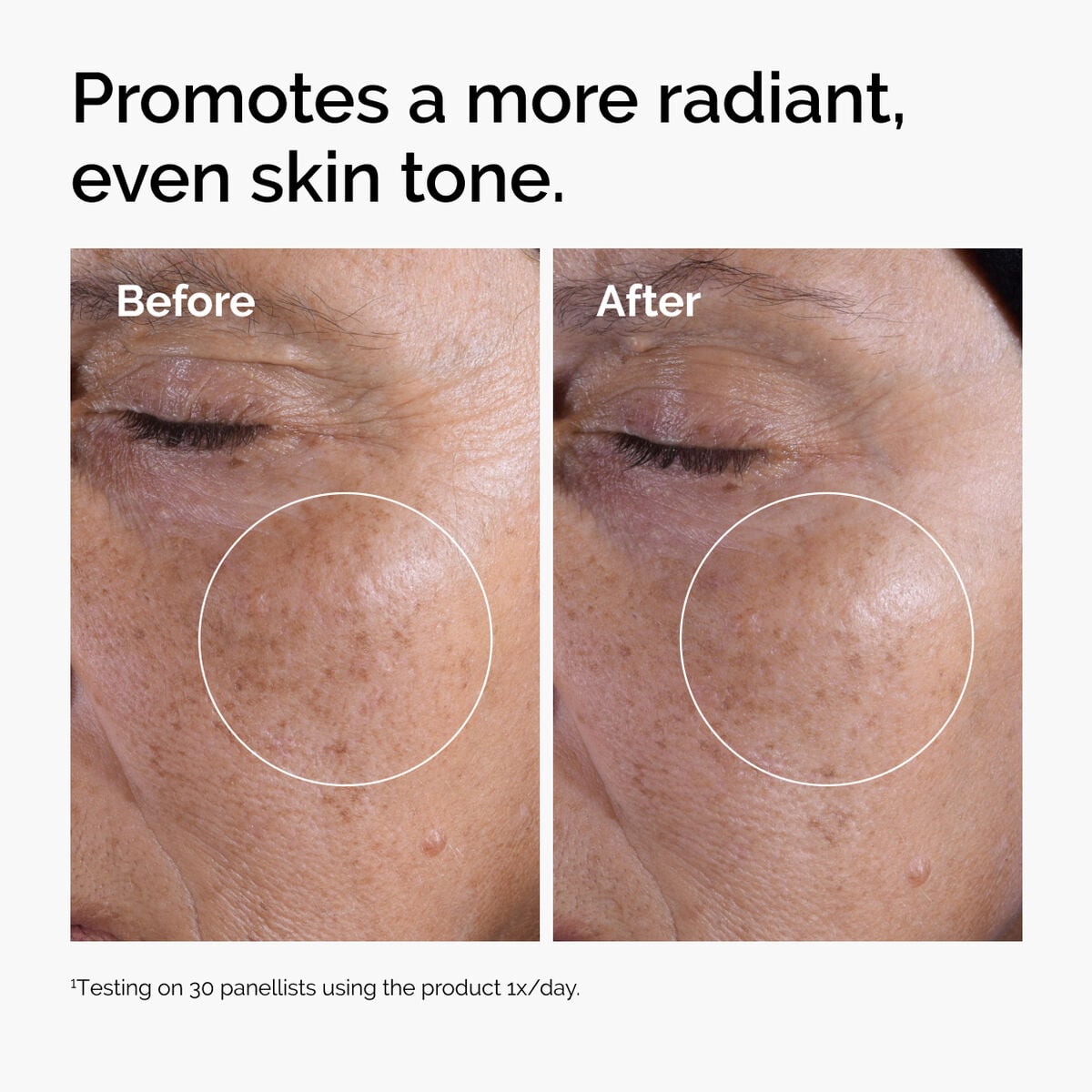glycolic-acid-7-exfoliating-toner-p6 ord-glycolic-before-after-radiance.jpg