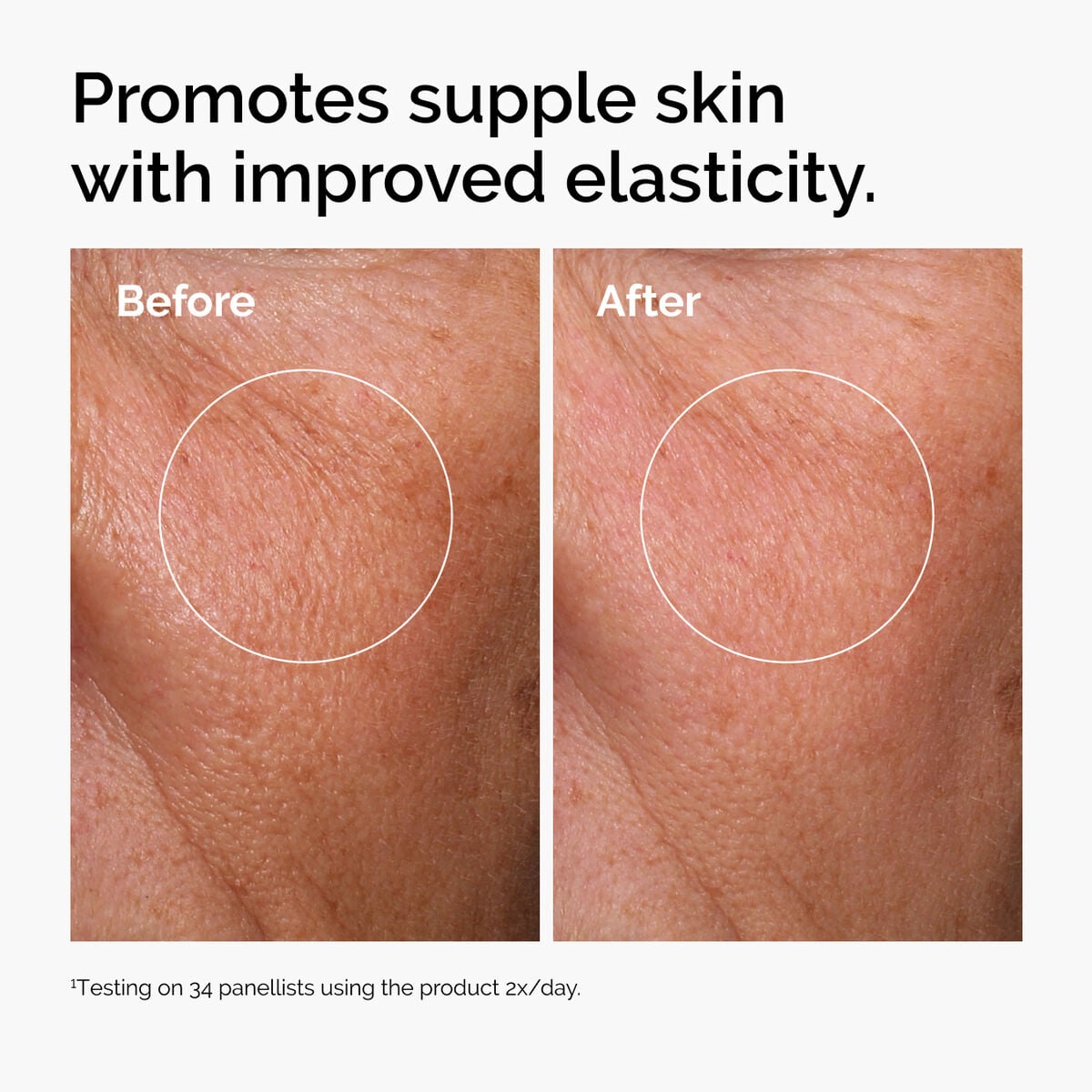 hyaluronic-acid-2-b5-with-ceramides-v1 ord-hyaluronic-acid-2pct-b5-hydrating-serum-before-after-elasticity.jpg