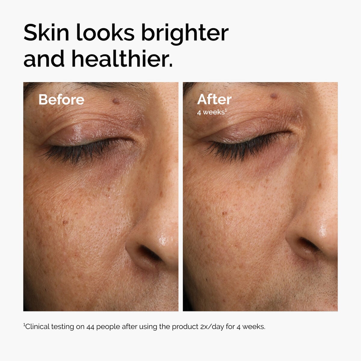 multi-antioxidant-radiance-serum-n6 ord-mars-before-after-healthy.jpg