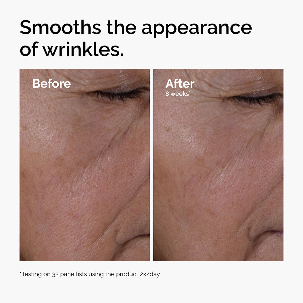 multi-peptide-ha-serum-z7 ord-multi-peptide-ha-serum-wrinkles-before-after.jpg