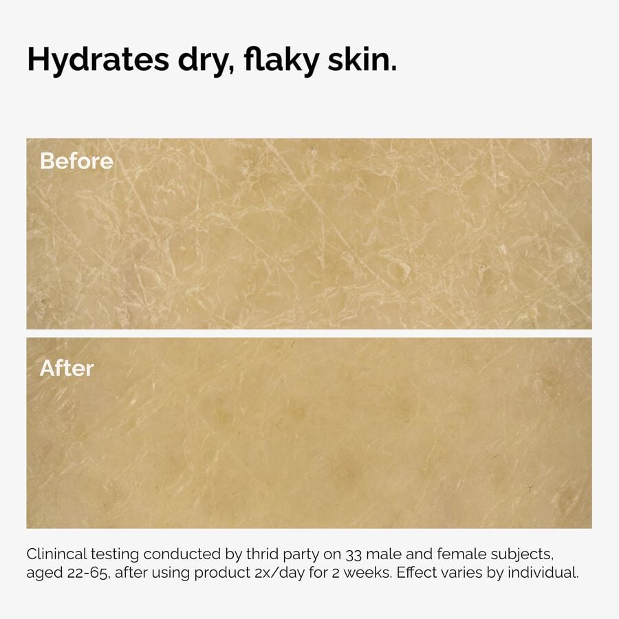the-body-care-collection-a1 ord-natural-moisturizing-factors-inulin-body-before-after-graphic-02.jpg