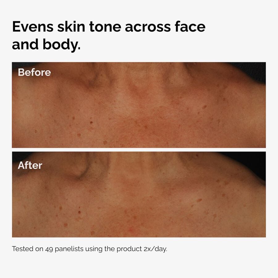 the-body-care-collection-a1 ord-niacinamide-face-body-serum-before-after-even-tone-graphic.jpg