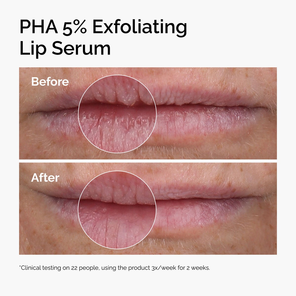 pha-5-exfoliating-lip-serum-i2 ord-pha-5pct-lip-exfoliating-serum-before-after.jpg