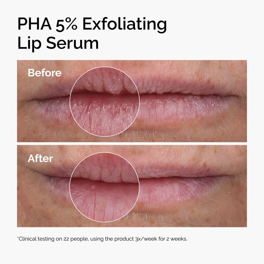 pha-5-exfoliating-lip-serum-a4 ord-pha-5pct-lip-exfoliating-serum-before-after.jpg