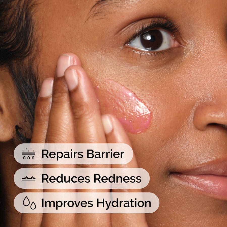 soothing-and-barrier-support-serum-set-q2 ord-soothing-barrier-support-serum-model-application-with-benefits.jpg