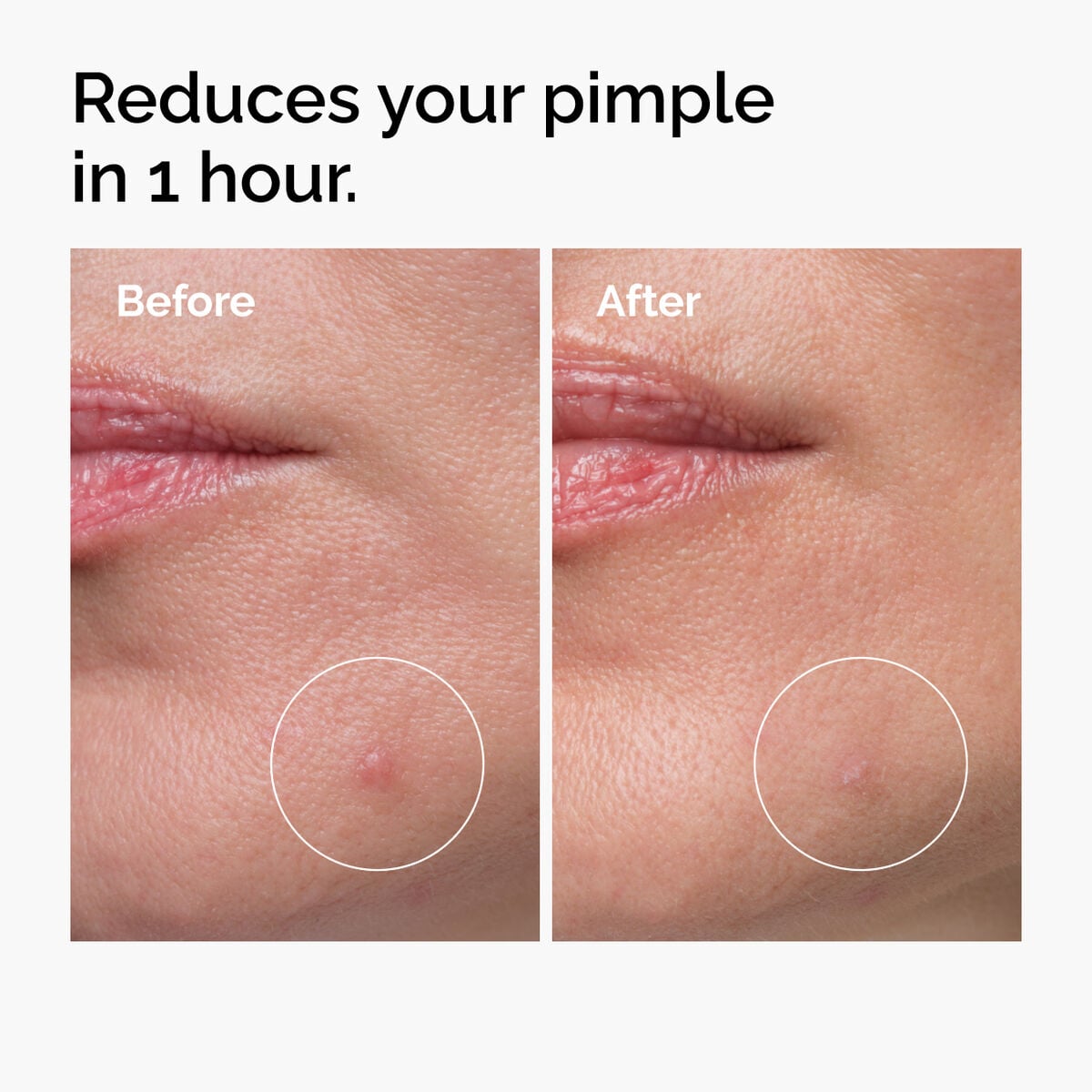 sulfur-10-powder-to-cream-concentrate-a2 ord-sulfur-10pct-powder-to-cream-concentrate-before-after-NA.jpg