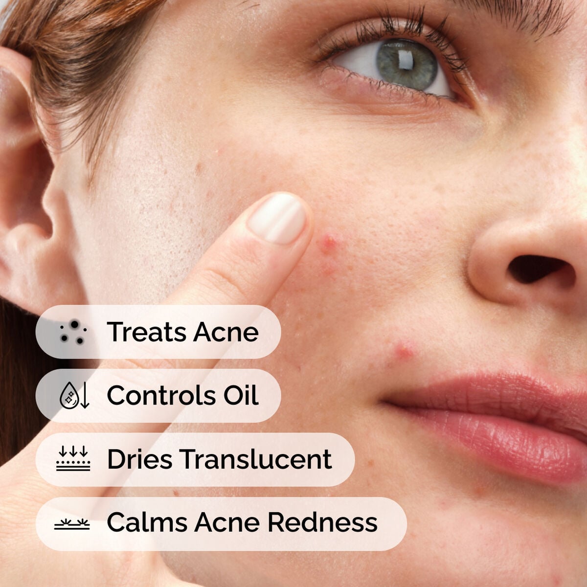 sulfur-10-powder-to-cream-concentrate-a2 ord-sulfur-10pct-powder-to-cream-concentrate-model-application-with-benefits-acne.jpg